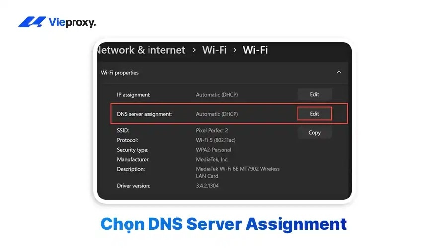 Chọn DNS Server Assignment